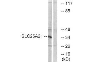 Western Blotting (WB) image for anti-Solute Carrier Family 25 (Mitochondrial Oxodicarboxylate Carrier), Member 21 (Slc25a21) (Internal Region) antibody (ABIN1851571) (SLC25A21 anticorps  (Internal Region))