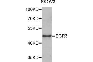Western blot analysis of extracts of SKOV3 cells, using EGR3 antibody (ABIN5975619) at 1/1000 dilution. (EGR3 anticorps)