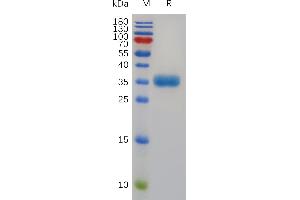 Human TP Protein, His Tag on SDS-PAGE under reducing condition. (TPSAB1 Protein (AA 19-275) (His tag))