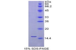 SDS-PAGE analysis of Human Selenoprotein X1 Protein. (MSRB1 Protéine)