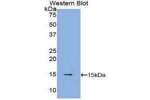 Western Blotting (WB) image for anti-POTE Ankyrin Domain Family, Member J (POTEJ) (AA 109-269) antibody (ABIN1171897) (POTEJ anticorps  (AA 109-269))