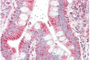 Human Small Intestine: Formalin-Fixed, Paraffin-Embedded (FFPE) (CSNK1A1 anticorps)