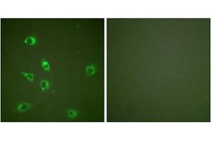 Immunofluorescence analysis of NIH/3T3 cells, using Glucagon antibody (ABIN5976409). (Glucagon anticorps  (Internal Region))