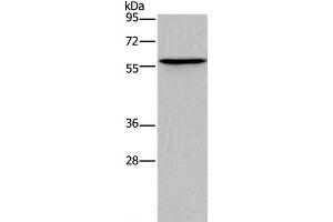 Western Blot analysis of Human lung cancer tissue using ADRA1B Polyclonal Antibody at dilution of 1:550 (ADRA1B anticorps)