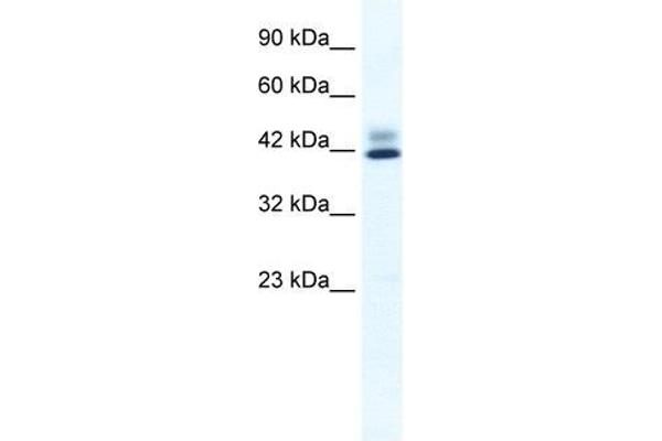 ZNF551 anticorps  (N-Term)