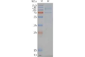 Human -Nanodisc, Flag Tag on SDS-PAGE (LGR6 Protéine)