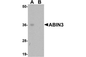 Western Blotting (WB) image for anti-TNFAIP3 Interacting Protein 3 (TNIP3) (C-Term) antibody (ABIN1030214) (TNIP3 anticorps  (C-Term))