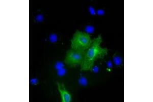 Anti-PKLR mouse monoclonal antibody (ABIN2453474) immunofluorescent staining of COS7 cells transiently transfected by pCMV6-ENTRY PKLR (RC206455). (PKLR anticorps)