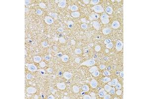 Immunohistochemistry of paraffin-embedded rat brain using SLC1A2 antibody (ABIN5995519) at dilution of 1/100 (40x lens). (SLC1A2 anticorps)