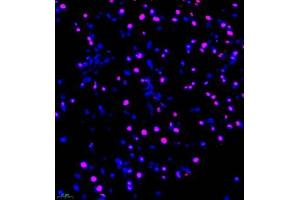 Immunofluorescence of paraffin embedded mouse pancreas using FUS (ABIN7075919) at dilution of 1:1000 (400x lens) (TLS/FUS anticorps)