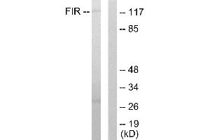 Western blot analysis of extracts from HuvEc cells, using FIR antibody. (FARP2 anticorps  (Internal Region))