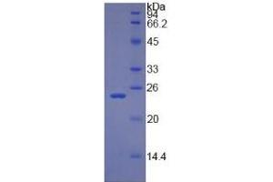 SDS-PAGE (SDS) image for Retinol Binding Protein 4, Plasma (RBP4) ELISA Kit (ABIN6574239)