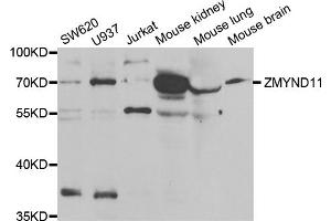 Western blot analysis of extracts of various cell lines, using ZMYND11 antibody (ABIN5973742) at 1/1000 dilution. (ZMYND11 anticorps)