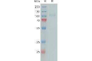 Human CFI Protein, His Tag on SDS-PAGE under reducing condition. (Complement Factor I Protein (CFI) (AA 19-583) (His tag))