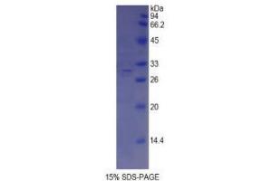 SDS-PAGE analysis of Mouse ABCA1 Protein. (ABCA1 Protéine)