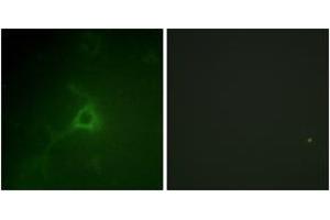 Immunofluorescence analysis of COS7 cells, using GFAP (Ab-38) Antibody. (GFAP anticorps  (AA 11-60))