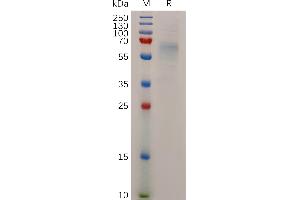 Human S Protein, His Tag on SDS-PAGE under reducing condition. (Stabilin 1 Protein (STAB1) (AA 638-1024) (His tag))