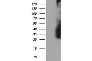 HEK293T cells were transfected with the pCMV6-ENTRY control (Left lane) or pCMV6-ENTRY LDLRAP1 (Right lane) cDNA for 48 hrs and lysed. (LDLRAP1 anticorps)