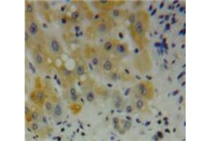 Used in DAB staining on fromalin fixed paraffin-embedded Liver tissue (Desmin anticorps  (AA 117-348))