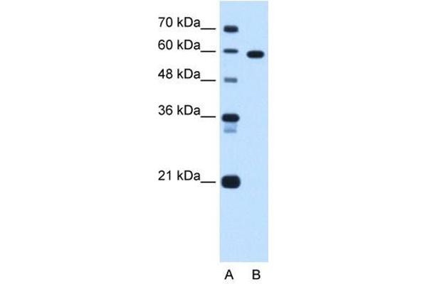 T-Box 15 anticorps  (C-Term)