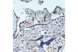 Immunohistochemistry of paraffin-embedded human placenta using HOX Rabbit mAb (ABIN7267764) at dilution of 1:100 (40x lens). (HOXA9 anticorps)
