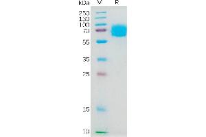 Human IL4RA Protein, hFc Tag on SDS-PAGE under reducing condition. (IL4 Receptor Protein (AA 26-232) (Fc Tag))