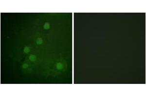 Immunofluorescence analysis of COS7 cells, using RAD52 (Ab-104) Antibody. (RAD52 anticorps  (AA 70-119))