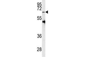 Western blot analysis of PRMT5 antibody and HL-60 lysate (PRMT5 anticorps  (AA 473-499))