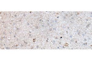 Immunohistochemistry of paraffin-embedded Human brain tissue using RAB4A Polyclonal Antibody at dilution of 1:40(x200) (Rab4 anticorps)