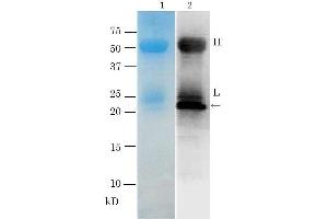 Western Blotting (WB) image for anti-TRH Toxin antibody (ABIN2452158)