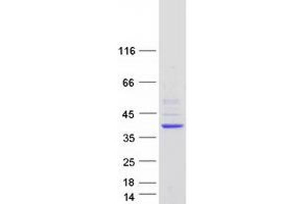 DHRS1 Protein (Transcript Variant 1) (Myc-DYKDDDDK Tag)