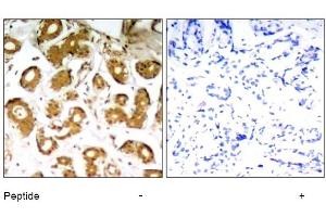Image no. 1 for anti-Nuclear Factor-kB p65 (NFkBP65) (Thr505) antibody (ABIN319322) (NF-kB p65 anticorps  (Thr505))