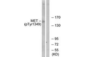 Western Blotting (WB) image for anti-Met Proto-Oncogene (MET) (pTyr1349) antibody (ABIN2888473) (c-MET anticorps  (pTyr1349))