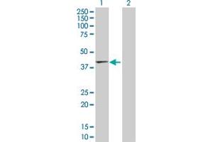 Western Blot analysis of TMOD2 expression in transfected 293T cell line by TMOD2 MaxPab polyclonal antibody. (TMOD2 anticorps  (AA 1-351))