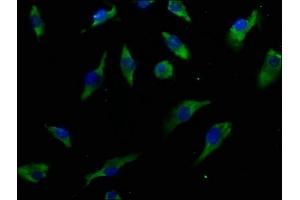 Immunofluorescence staining of U251 cells with ABIN7156793 at 1:50, counter-stained with DAPI. (IL13 Receptor alpha 1 anticorps  (AA 22-234))