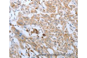 Immunohistochemistry of Human brain using FGF1 Polyclonal Antibody at dilution of 1:50 (FGF1 anticorps)