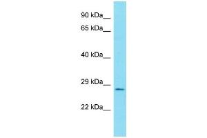 Host:  Rabbit  Target Name:  RELA  Sample Type:  Uterus Tumor lysate  Antibody Dilution:  1. (NF-kB p65 anticorps  (N-Term))