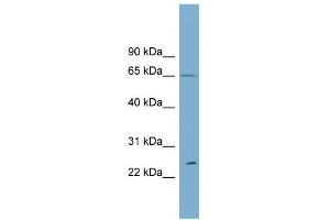 WB Suggested Anti-RPN2 Antibody Titration:  0. (Ribophorin II anticorps  (Middle Region))