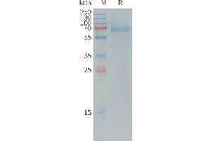 Human Protein, mFc Tag on SDS-PAGE under reducing condition. (DKK1 Protein (AA 32-266) (mFc Tag))