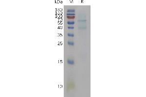 Mouse Protein, His Tag on SDS-PAGE under reducing condition. (BMP6 Protein (AA 21-510) (His tag))