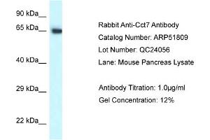 Western Blotting (WB) image for anti-Chaperonin Containing TCP1, Subunit 7 (Eta) (CCT7) (C-Term) antibody (ABIN970320) (CCT7 anticorps  (C-Term))