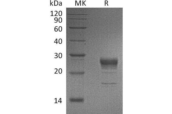 FGF7 Protein (His tag)