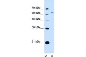 Western Blotting (WB) image for anti-WSC Domain Containing 2 (WSCD2) antibody (ABIN2463039) (WSCD2 anticorps)