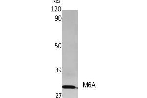 Western Blot analysis of extracts from rat stomach, using M6A Polyclonal Antibody. (METTL3 anticorps  (AA 140-220))