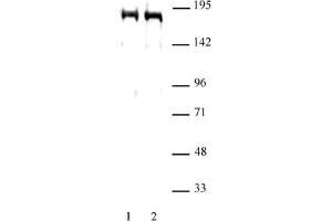 DNMT1 antibody (pAb) tested by Western blot. (DNMT1 anticorps  (AA 1-110))