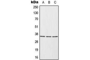 Western blot analysis of HUR expression in HeLa (A), Ramos (B), Jurkat (C) whole cell lysates. (ELAVL1 anticorps  (Center))