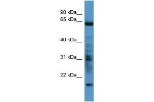 WB Suggested Anti-GRK7 Antibody Titration: 0. (GRK7 anticorps  (C-Term))