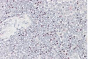 Immunohistochemistry (IHC) image for anti-Large Proline-Rich Protein BAT3 (BAT3) antibody (ABIN5926991) (BAT3 anticorps)
