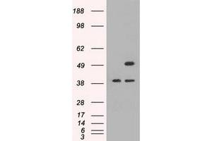 HEK293T cells were transfected with the pCMV6-ENTRY control (Left lane) or pCMV6-ENTRY CD4 (Right lane) cDNA for 48 hrs and lysed. (CD4 anticorps)