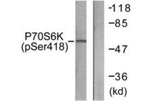 Western blot analysis of extracts from HT29 cells treated with serum 20% 15', using p70 S6 Kinase (Phospho-Ser418) Antibody. (RPS6KB1 anticorps  (pSer418))